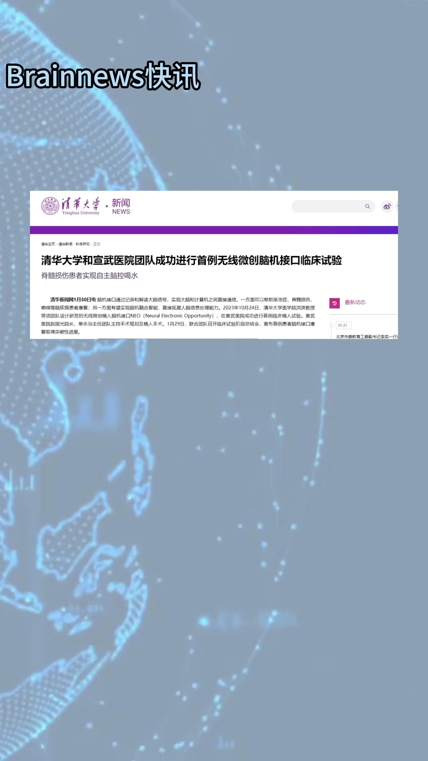 我国首例侵入式脑机接口临床试验成功