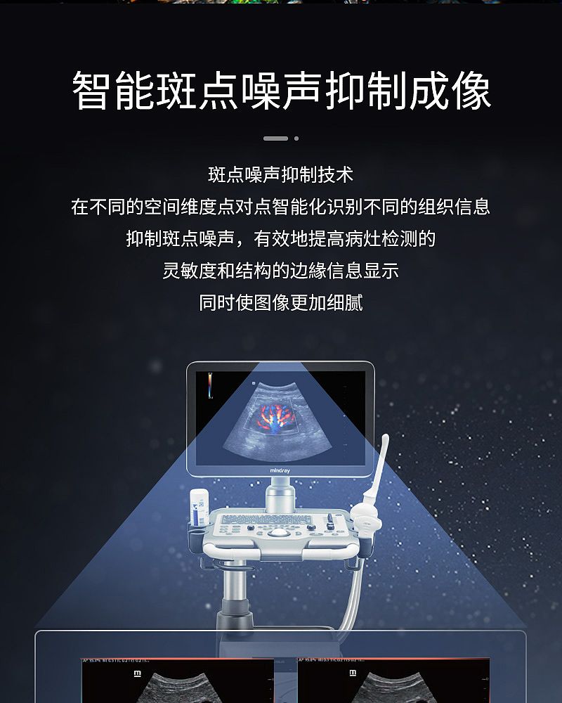 迈瑞医疗获得发明专利授权:“超声成像系统及其供电方法、超声成像设备及其供电装置”