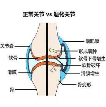 我国科学家向“困扰近6亿人的病痛”发起进攻