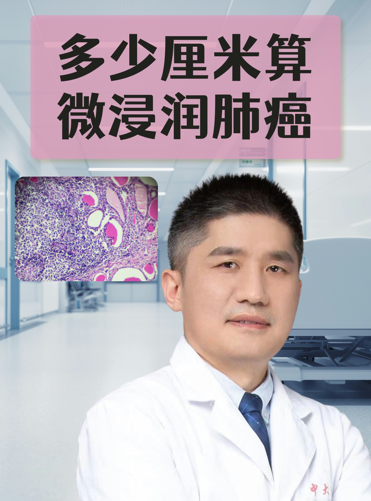 专家：晚期肺癌的治疗目标已经转向追求“延长生存”