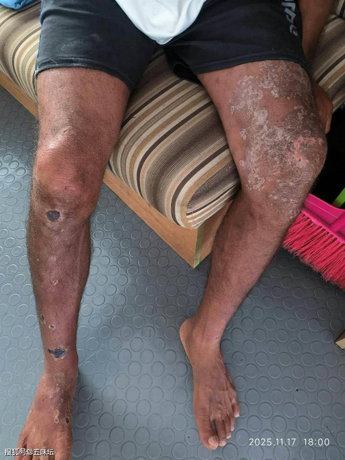 辽宁大连:一货船船体断裂进水 8名遇险船员全部获救