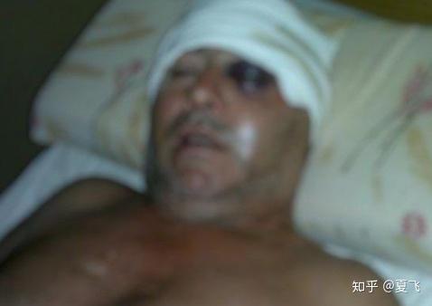 马拉多纳死亡案件开始重审