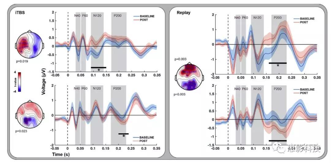 中外科研人员联合揭示大脑皮层“地形图”